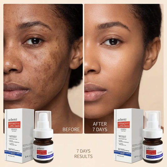 Aobenz dark spot remover serum
