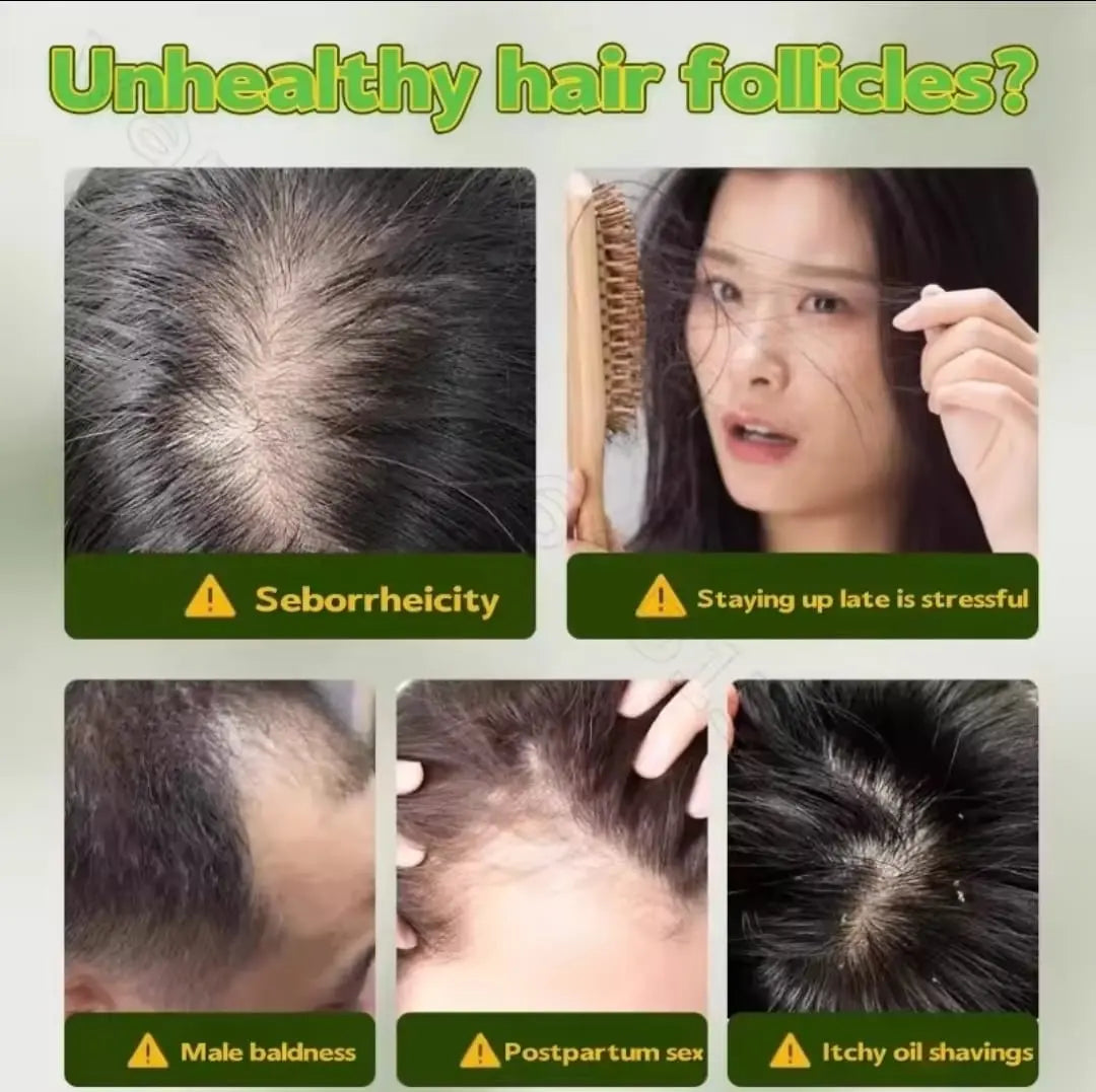 Chinese 12-herb soap for hair growth and thickening and natural dandruff removal